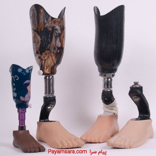طراحی و ساخت انواع پای مصنوعی، دست مصنوعی و انگشت