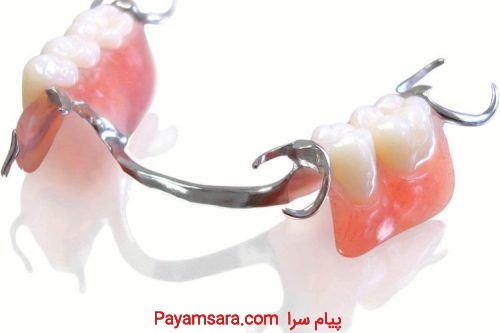 پایه پلاک دندان