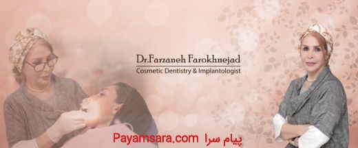 ایمپلنت و لیمنت دندان در تهران