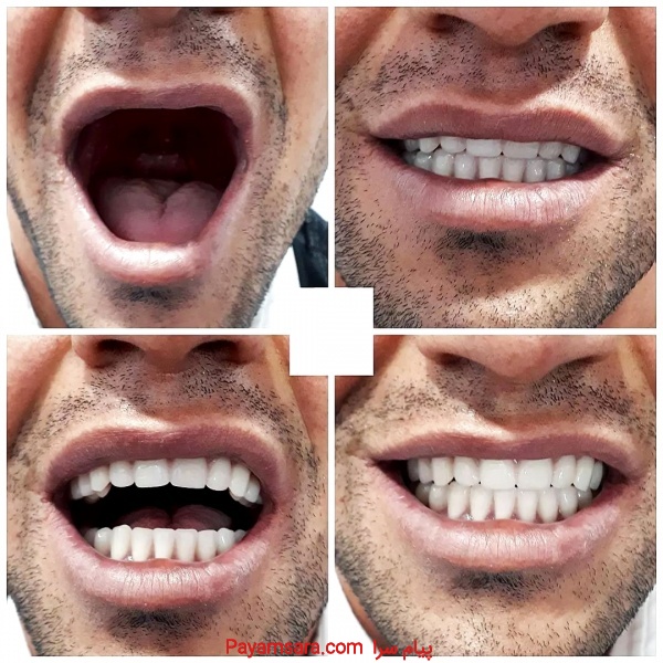 دندانسازی‌پارسیل((متخصص ساخت انواع دندان))