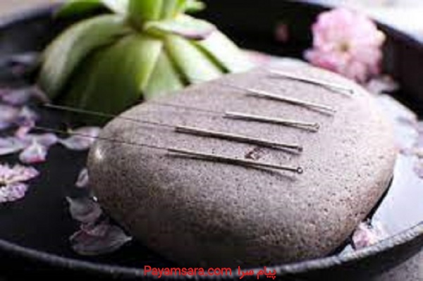 آموزش طب سوزنی